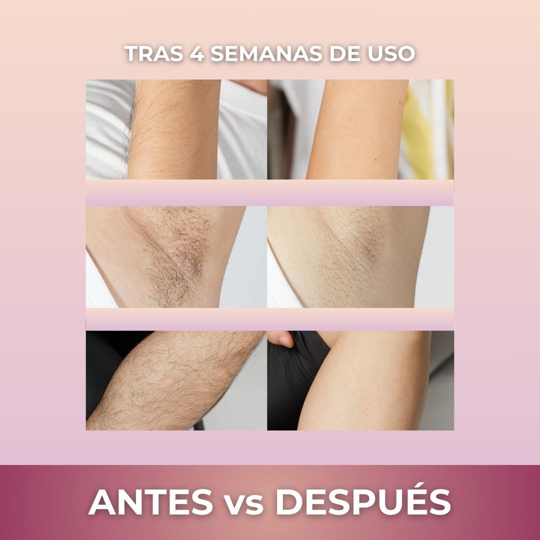 Depiladora IPL