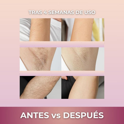 Depiladora IPL